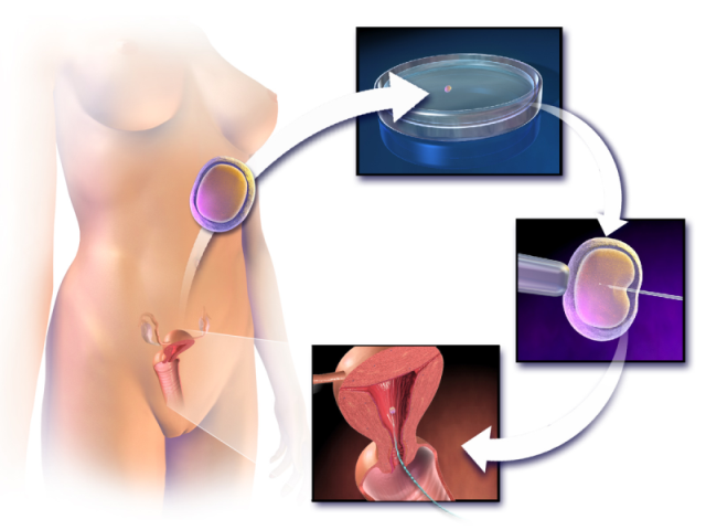 Infertility Specialist in Udaipur, Bhilwara, Ajmer 