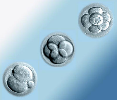 Infertility Centre in Udaipur, Bhilwara, Ajmer 