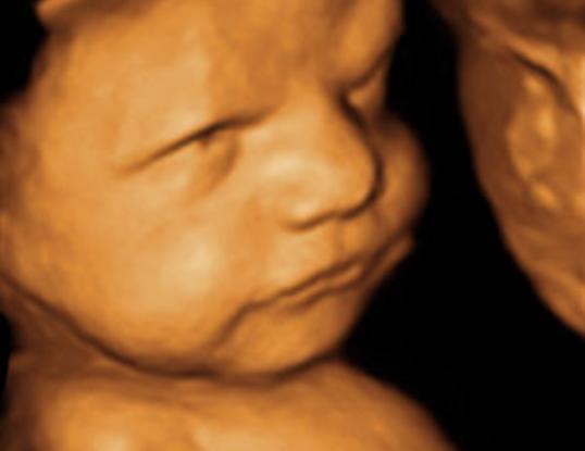 Test Tube Baby Centre in Udaipur, Bhilwara, Ajmer